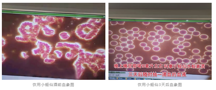 水蛭素、小蛭仙酒、醬香水蛭酒