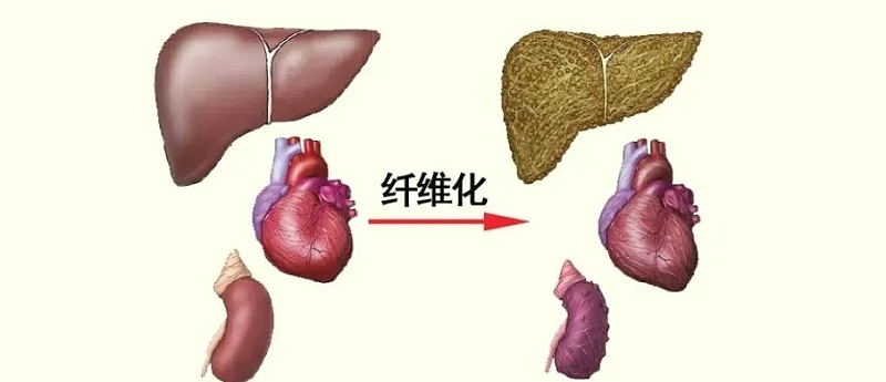 水蛭素、活血化瘀、纖維化