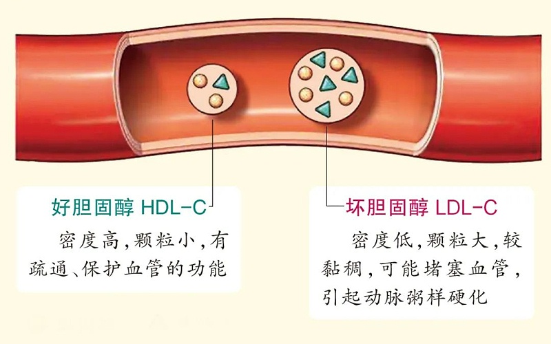 水蛭素、膽固醇、壯醫(yī)水蛭療法培訓(xùn)