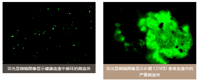 水蛭素、老年癡呆、前列腺、陽(yáng)康