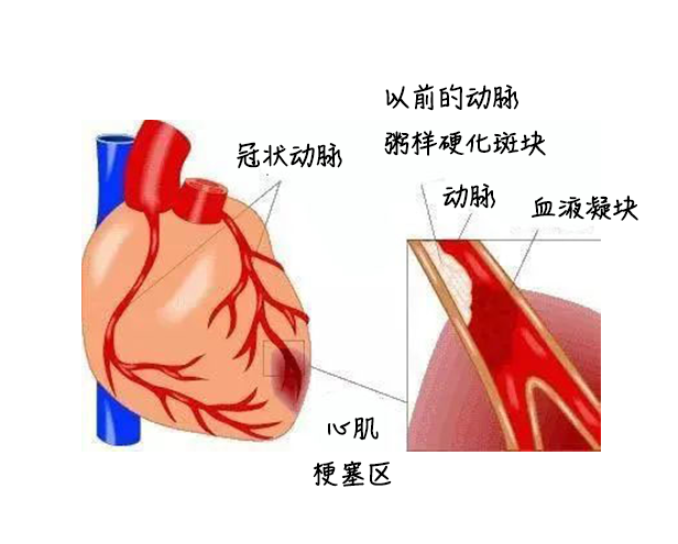 中醫(yī)藥健康旅游、心梗、面癱