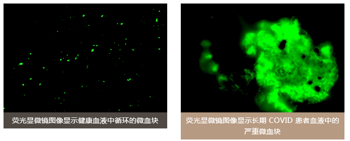 水蛭素、陽(yáng)康、烏梅、壯醫(yī)水蛭療法