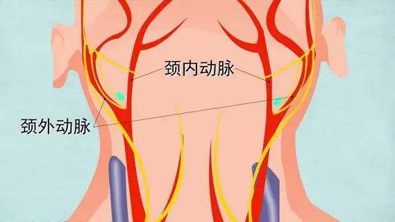 水蛭素、血管堵塞、粥樣硬化