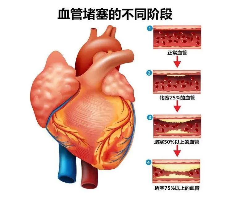 壯醫(yī)水蛭療法，天然水蛭素